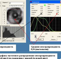 Маммограф МЭМ 20-08