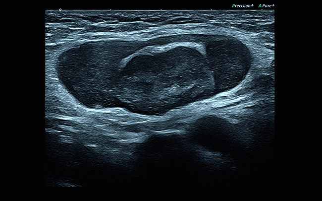 CANON/Toshiba Aplio i700