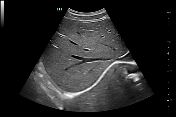 Mindray DC-60 Exp X-Insight