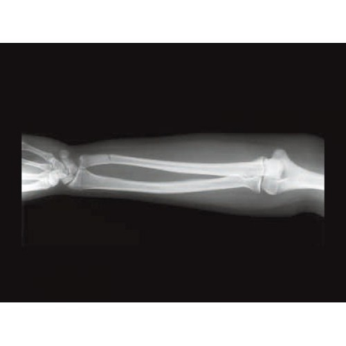 Стационарный рентген GE XR 6000