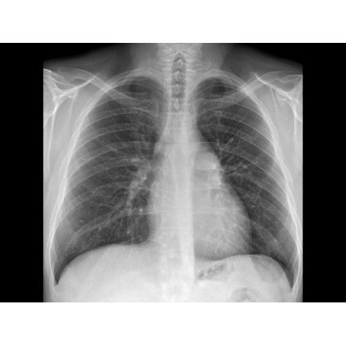 Рентген аппарат GE Optima XR 646