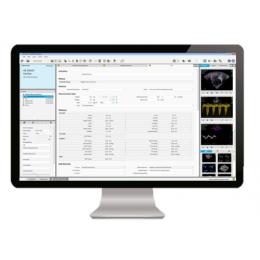 ViewPoint 6 и комплект EchoPAC Suite для кардиологических исследований